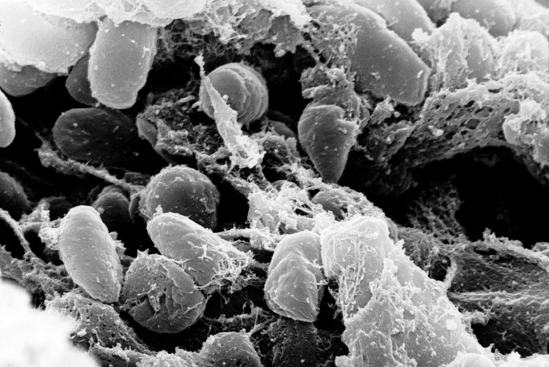 Yersinia_pestis чума чумная палочка